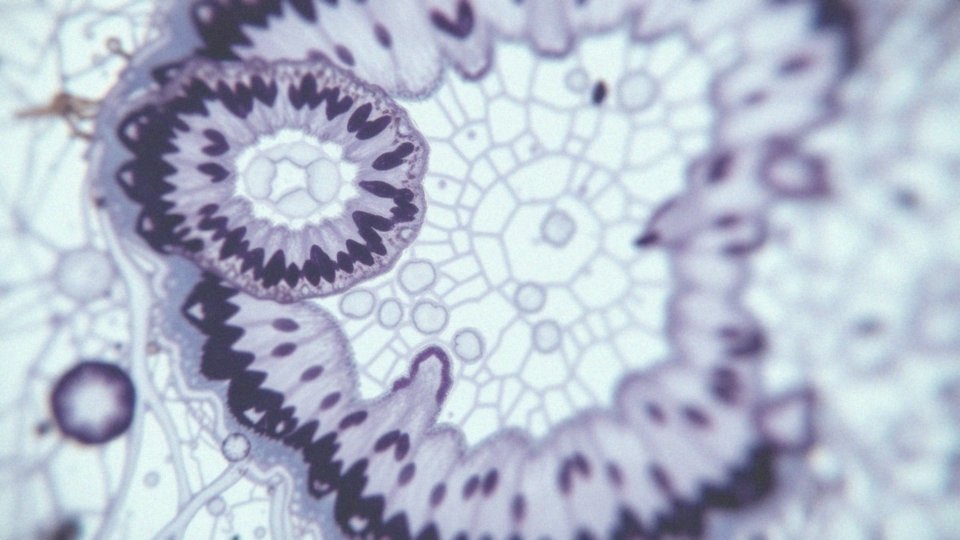 Jakie badania histopatologiczne są stosowane w diagnostyce polipów?